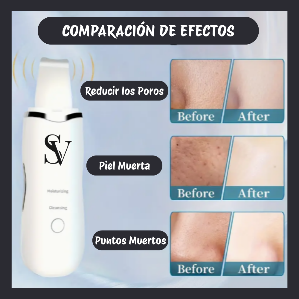 ✨ SkinWave™ Pro – Paleta Ultrasónica de Limpieza Facial 5 en 1 ✨