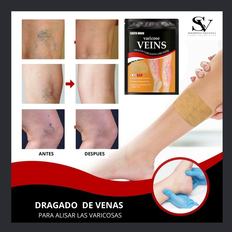 Parche Varices- CircuPatch™ y  Masajeador de Pie- PlantarEase™ (Pack)