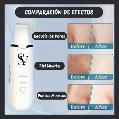 ✨ SkinWave™ Pro – Paleta Ultrasónica de Limpieza Facial 5 en 1 ✨